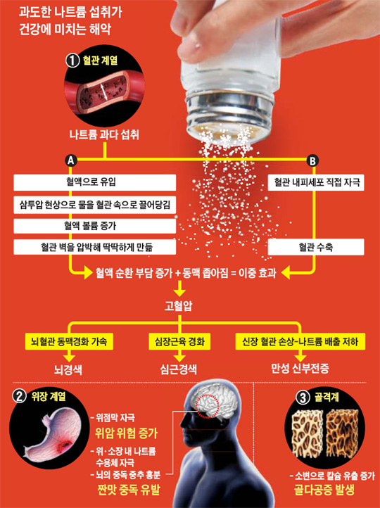 나트륨혈증과 고혈압의 상호작용