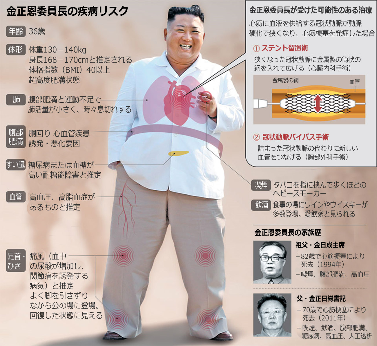 金正恩の身長・体重は？2026年最新の170cm推定と140キロ台報道を徹底解説