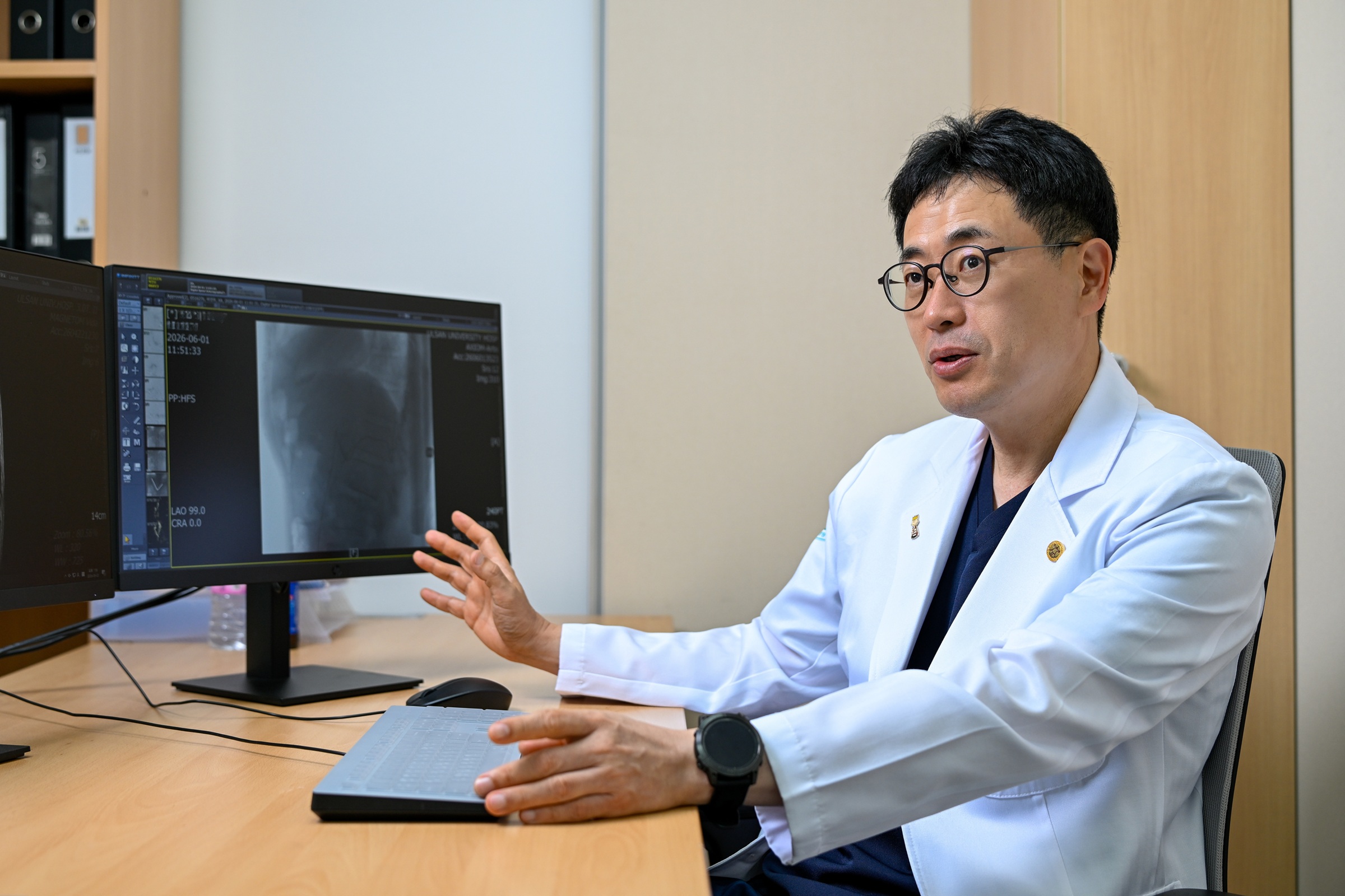 脳動脈瘤は血管内治療で負担軽減 FASTで早期受診促す - ChosunBiz