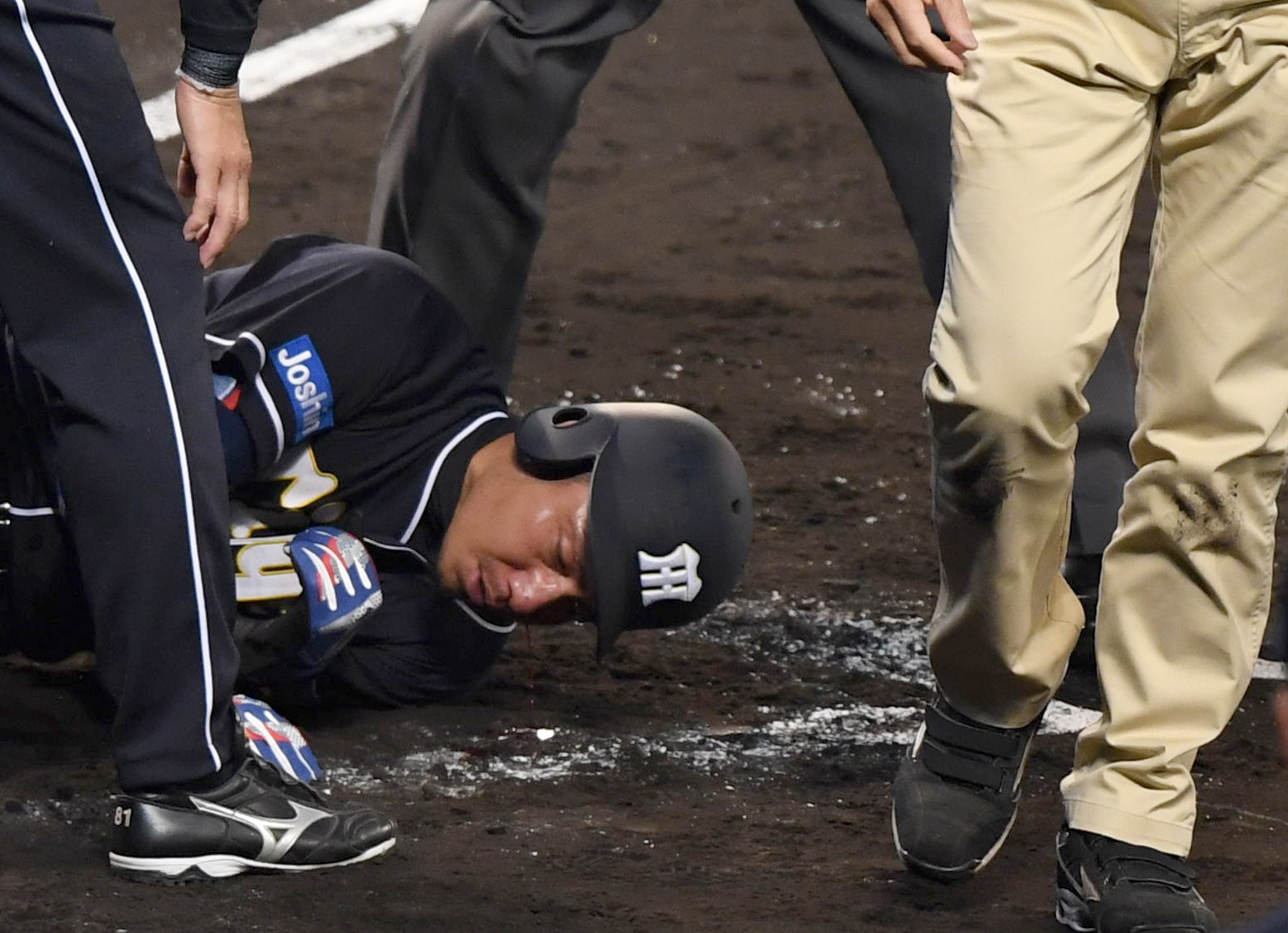 甦る甲子園名場面】鳥谷鉄人伝説ここにあり！ 大流血顔面死球翌日