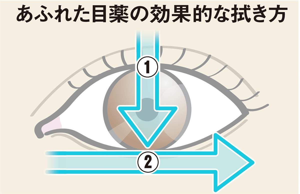 あふれた目薬はパチパチでなく縦 横に拭き取るべき 1 2ページ 産経ニュース