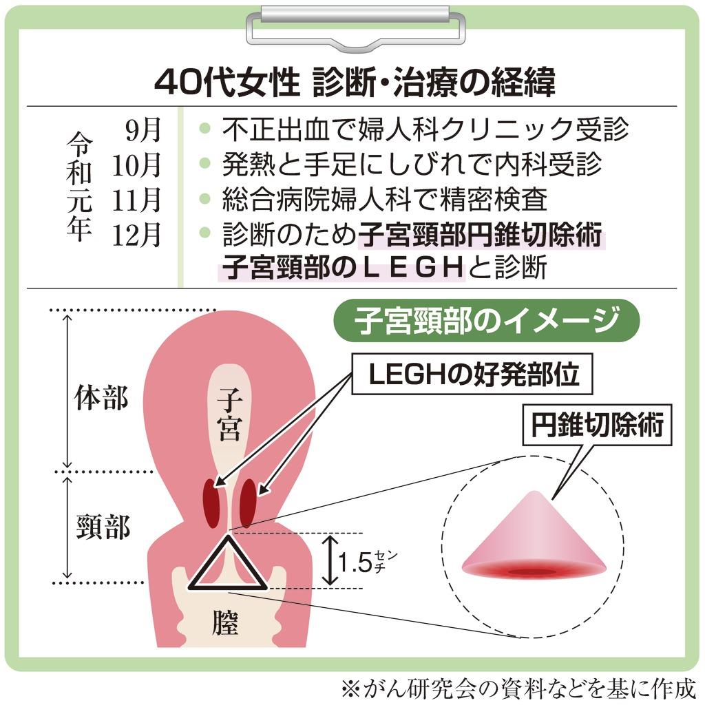 がん電話相談から q 子宮頸部良性疾患 子宮全摘勧められたが 1 2ページ 産経ニュース