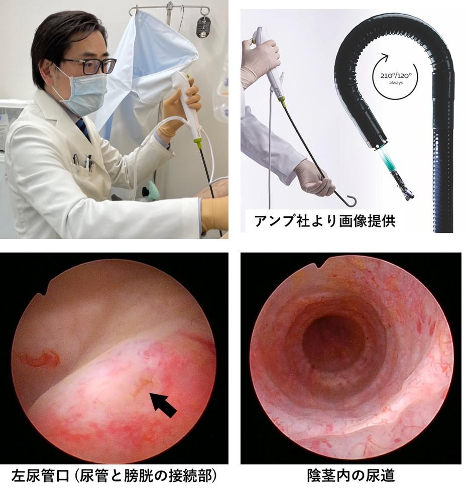 膀胱 鏡 検査