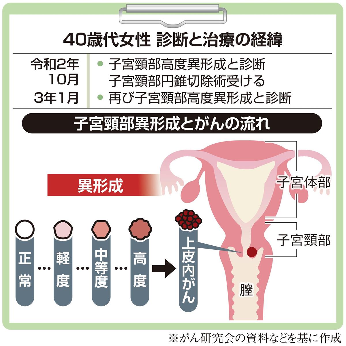 がん電話相談から 円錐切除術後 子宮頸部高度異形成と再診断 1 2ページ 産経ニュース