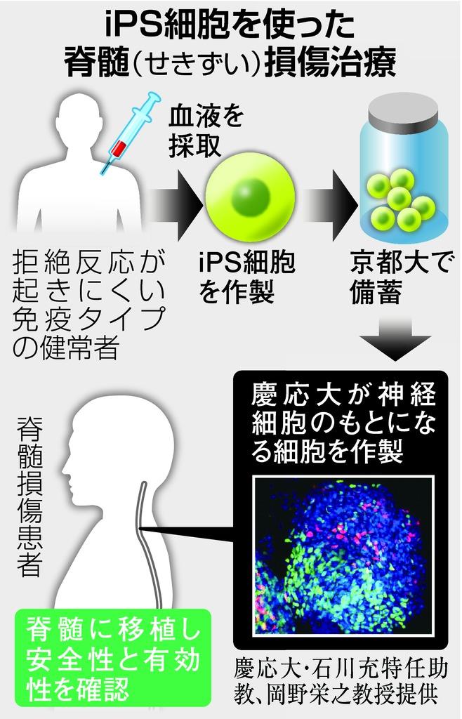 ｉｐｓで脊髄損傷治療 慶応大が大筋了承 来年にも移植 1 2ページ 産経ニュース