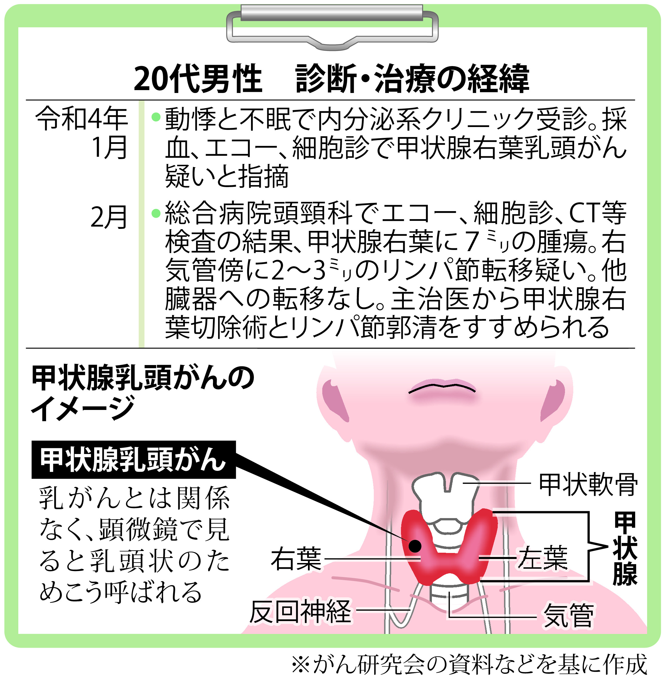 がん電話相談から】20代男性、甲状腺乳頭がんで手術を受ける