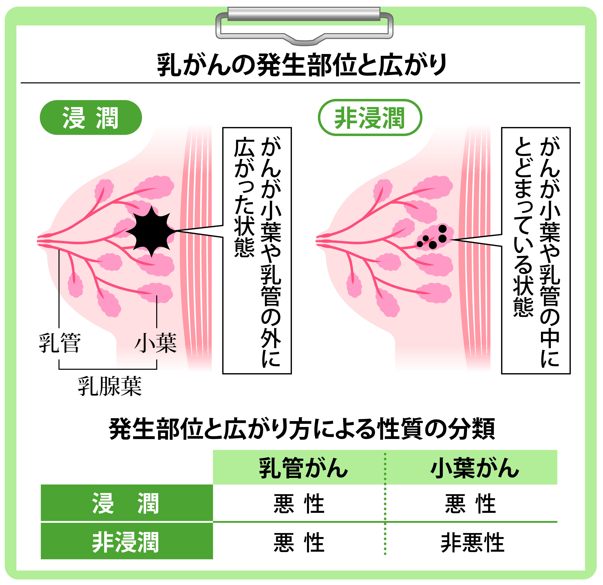 がん電話相談から】乳がん切除 断端陽性でも再手術不要？ - 産経ニュース