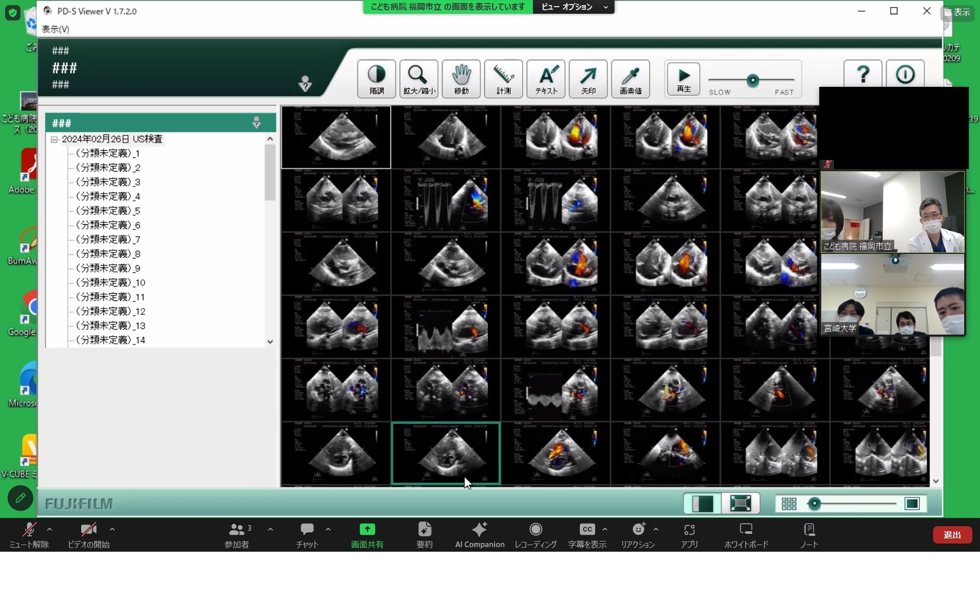 小児心臓外科の要点と盲点 Amazon.co.jp: 小児心臓外科の要点と盲点 (心臓外科knack & pitfalls