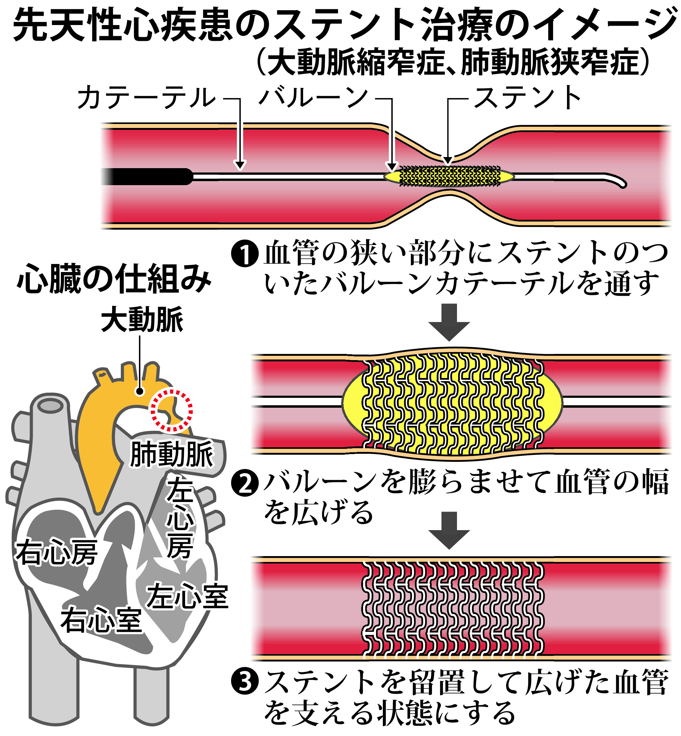 先天性心疾患 楽天ブックス: 図解先天性心疾患第2版 - 血行動態の理解と外科