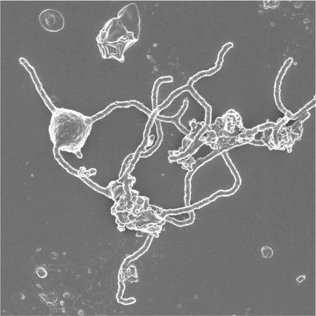 びっくりサイエンス】人や動植物の祖先に最も近い微生物を発見 太古の