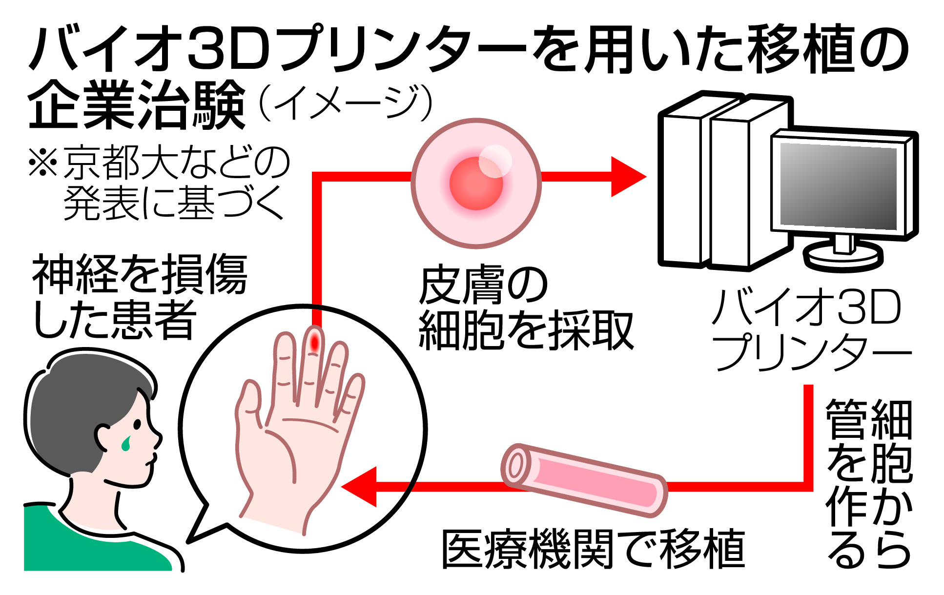 3Dプリンターで神経再生 令和8年にも実用化、京都大 - 産経ニュース