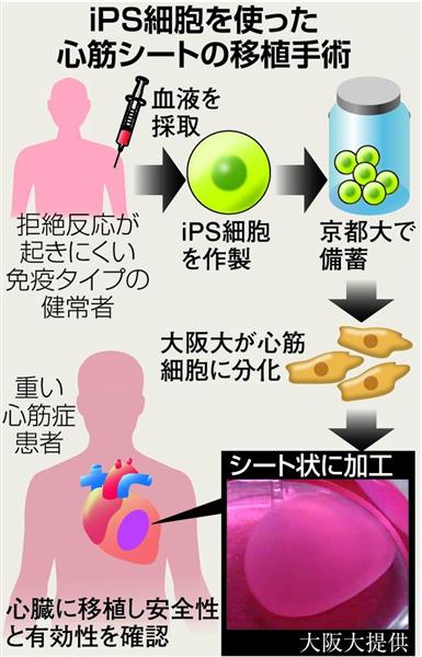 西論 ｉｐｓ細胞 新段階に 冷静に成果見極める態度を 1 4ページ 産経ニュース