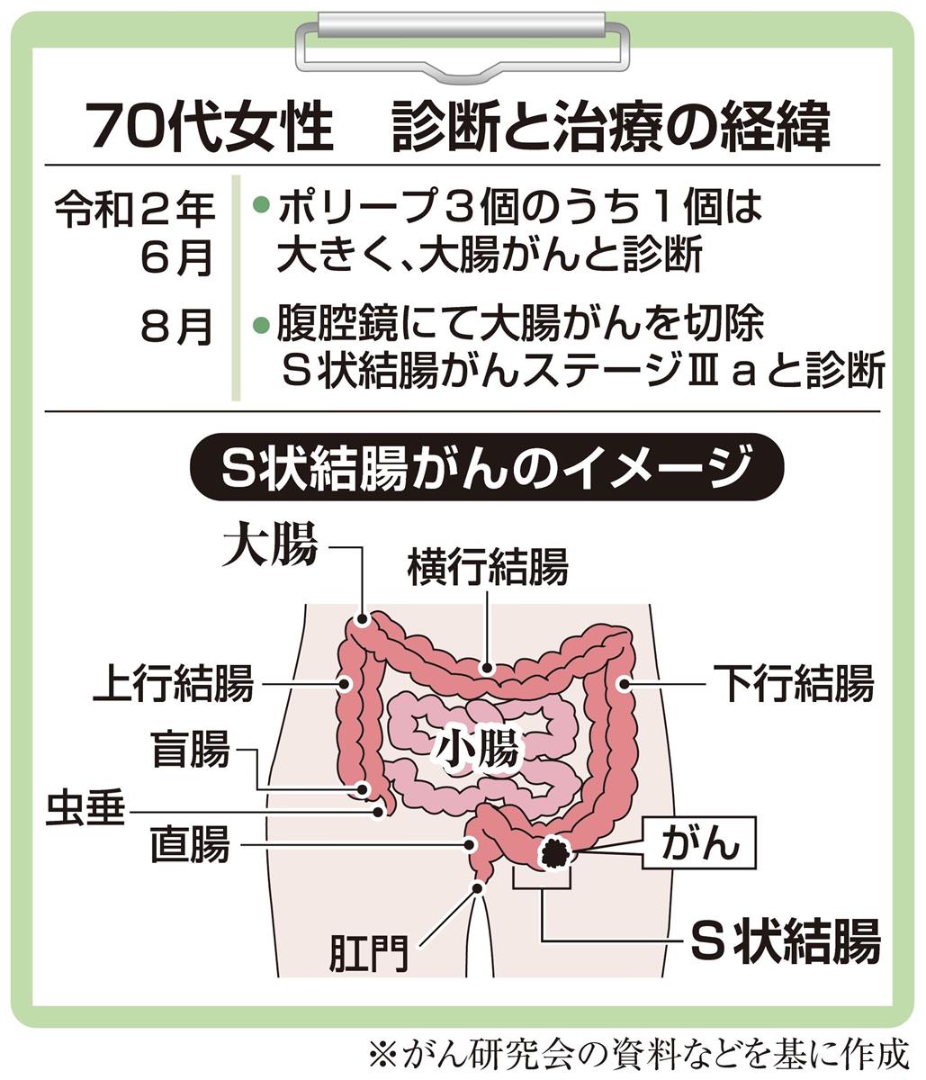 がん電話相談から】大腸がん術後、ＣＴ検査の被曝が心配（1/2ページ 