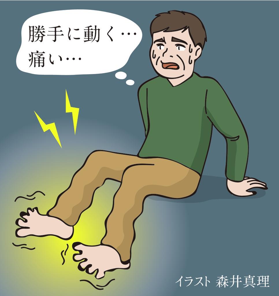 痛みを知る 痛む足動く趾症候群 足指がくねって動く 森本昌宏 1 2ページ 産経ニュース