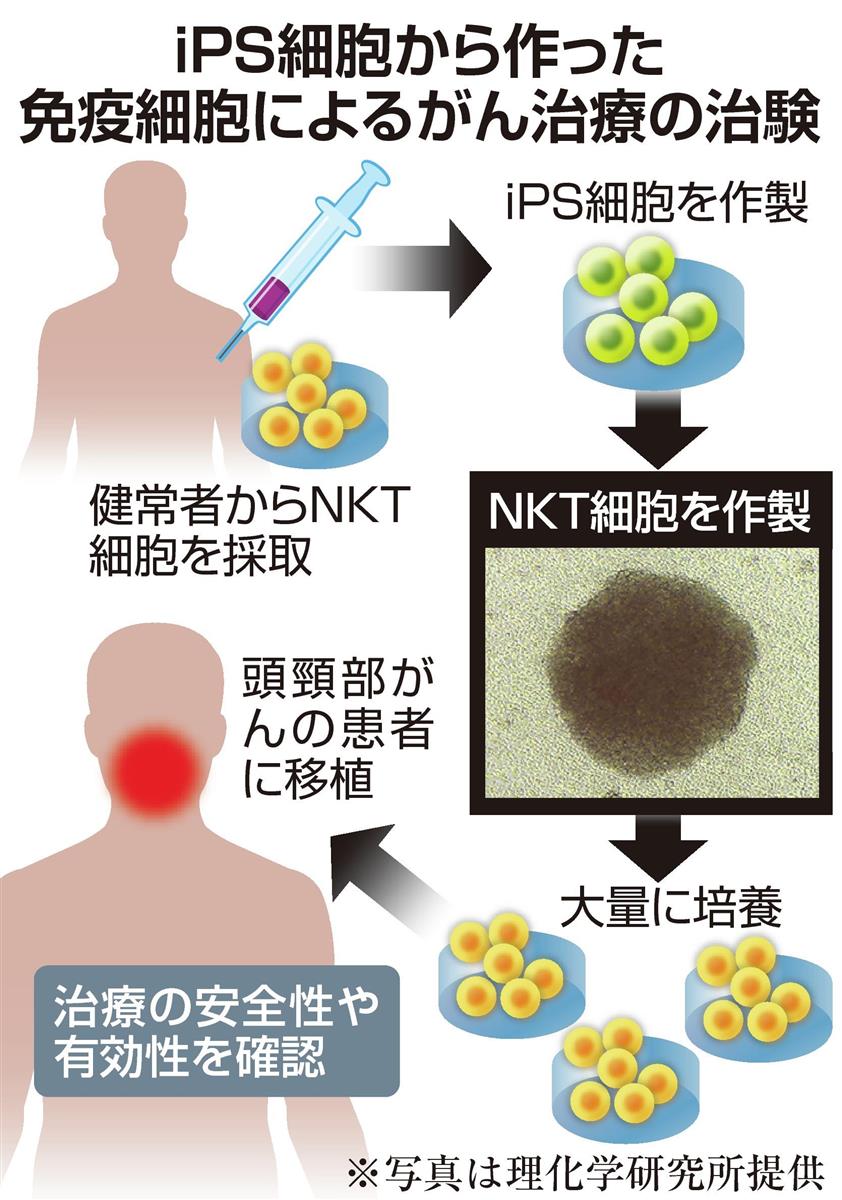 独自 ｉｐｓがん治療 国内初の移植実施 千葉大など免疫細胞利用 産経ニュース