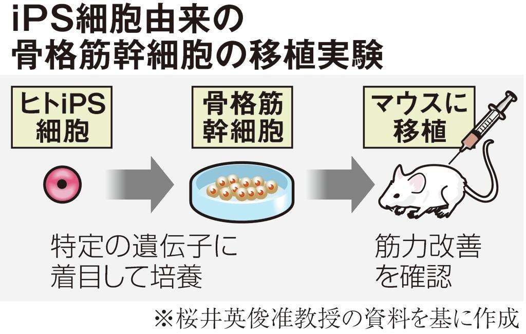 ｉｐｓ細胞で筋ジス治療に光 マウスで筋力改善を確認 産経ニュース