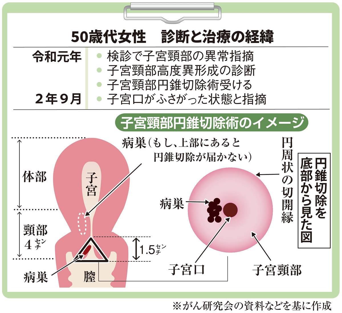 子宮 口 届か ない