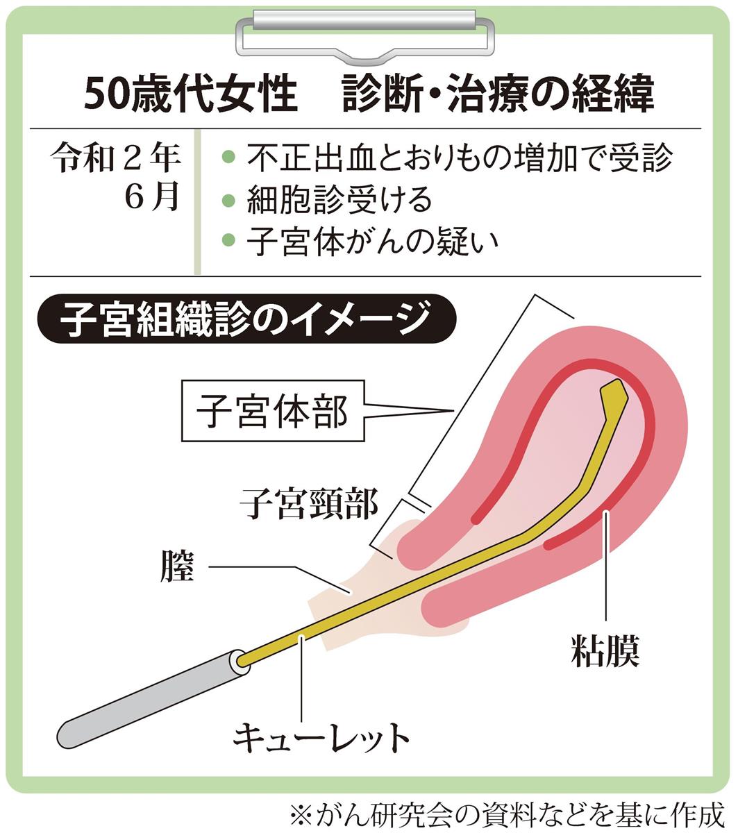 がん電話相談から 子宮体がんの疑い 今後どうすれば 1 2ページ 産経ニュース