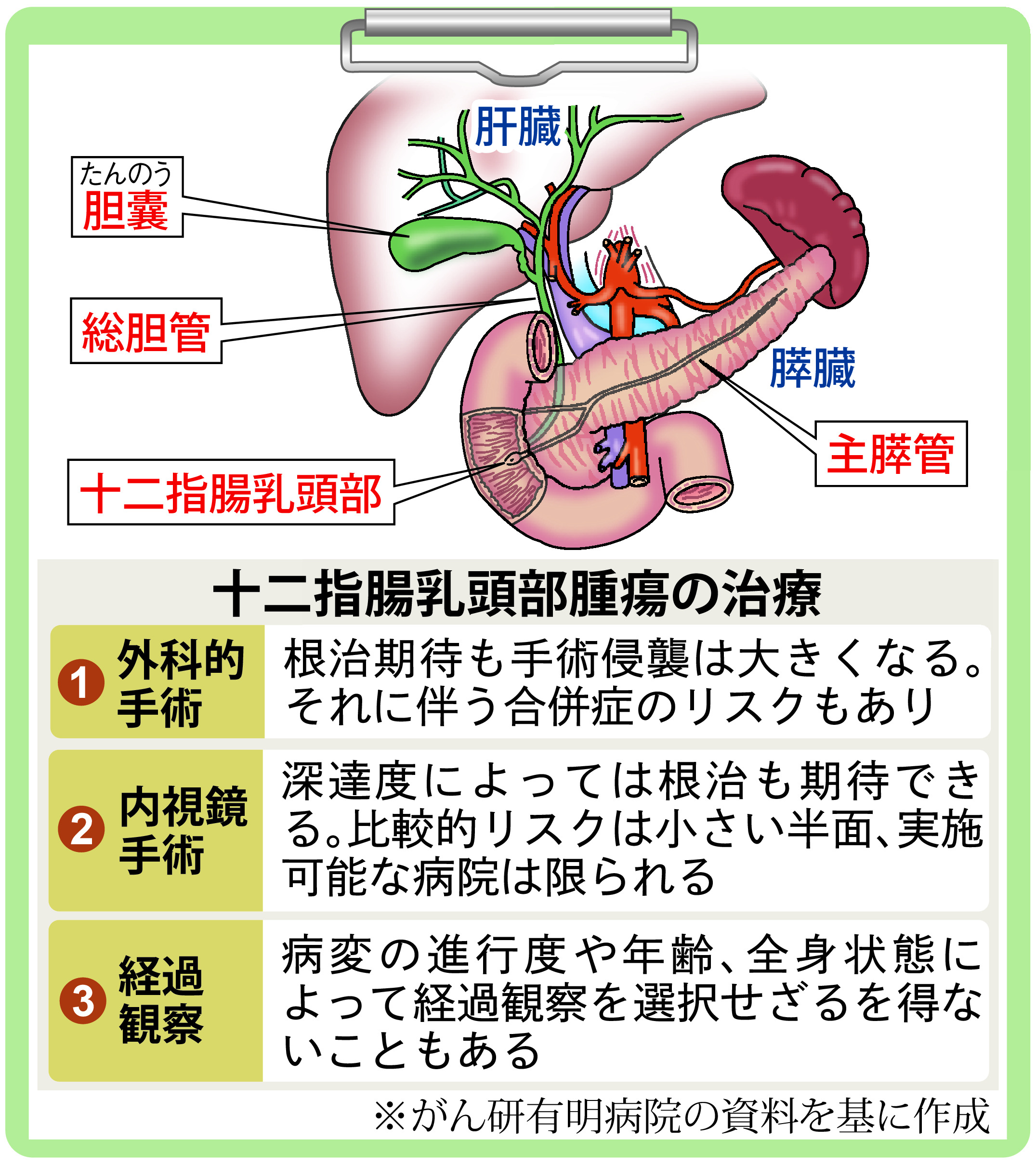 がん電話相談 十二指腸乳頭部腫瘍がん化の懸念 手術は 産経ニュース