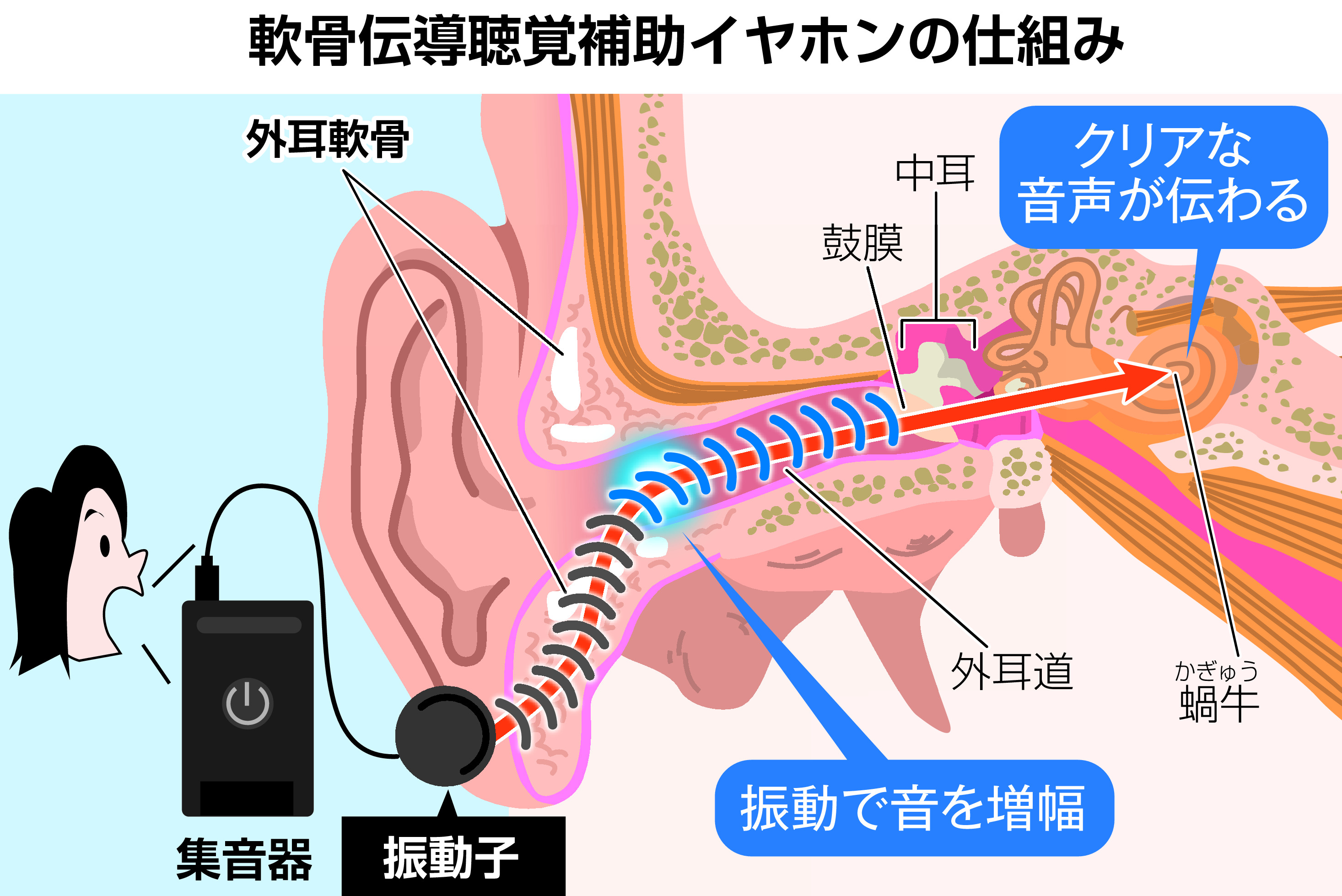 聴力 ストア イヤホン