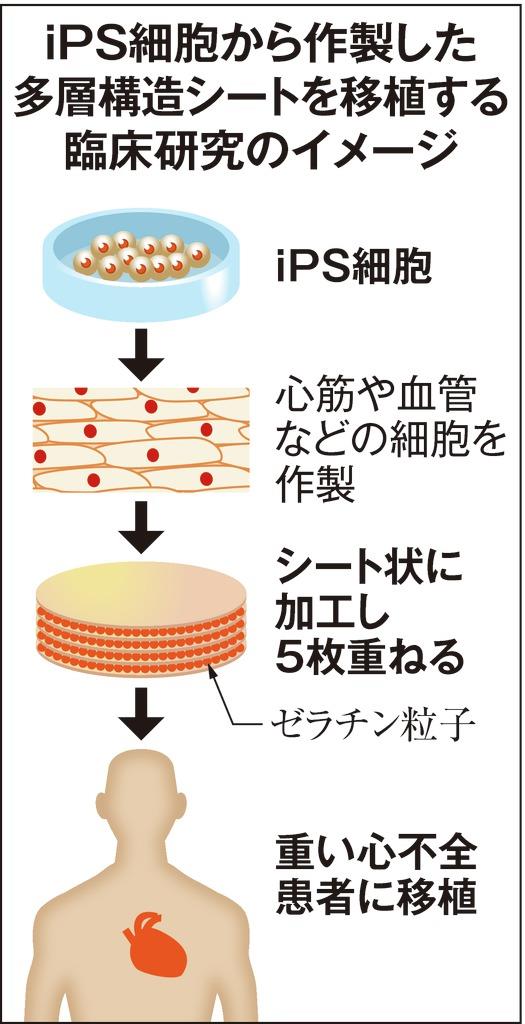 京大病院がips心臓治療へ 学内委員会で承認 国内3例目 産経ニュース