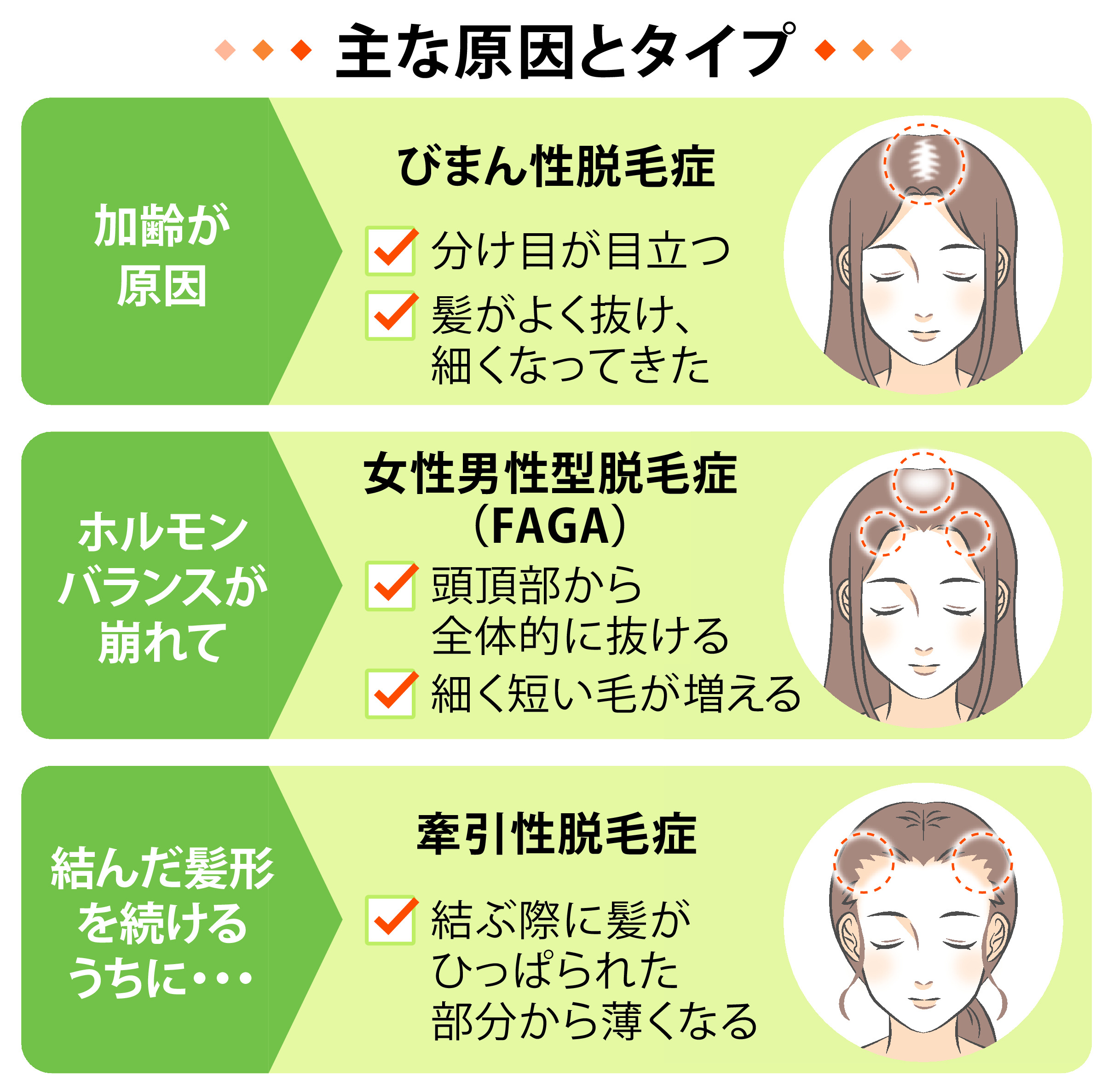 きょうからヘア活】女性の薄毛は理由さまざま - 産経ニュース