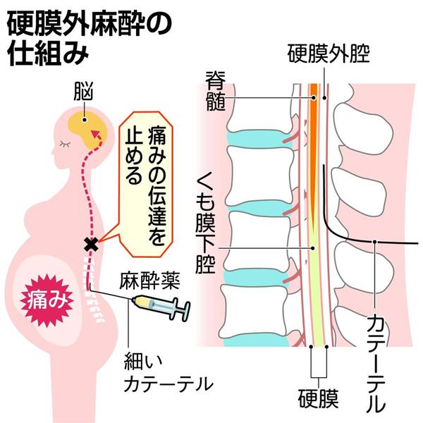麻酔ミスで母子とも植物状態」家族、京都の医院を提訴 医院側「適切な措置」（1/2ページ） - 産経ニュース