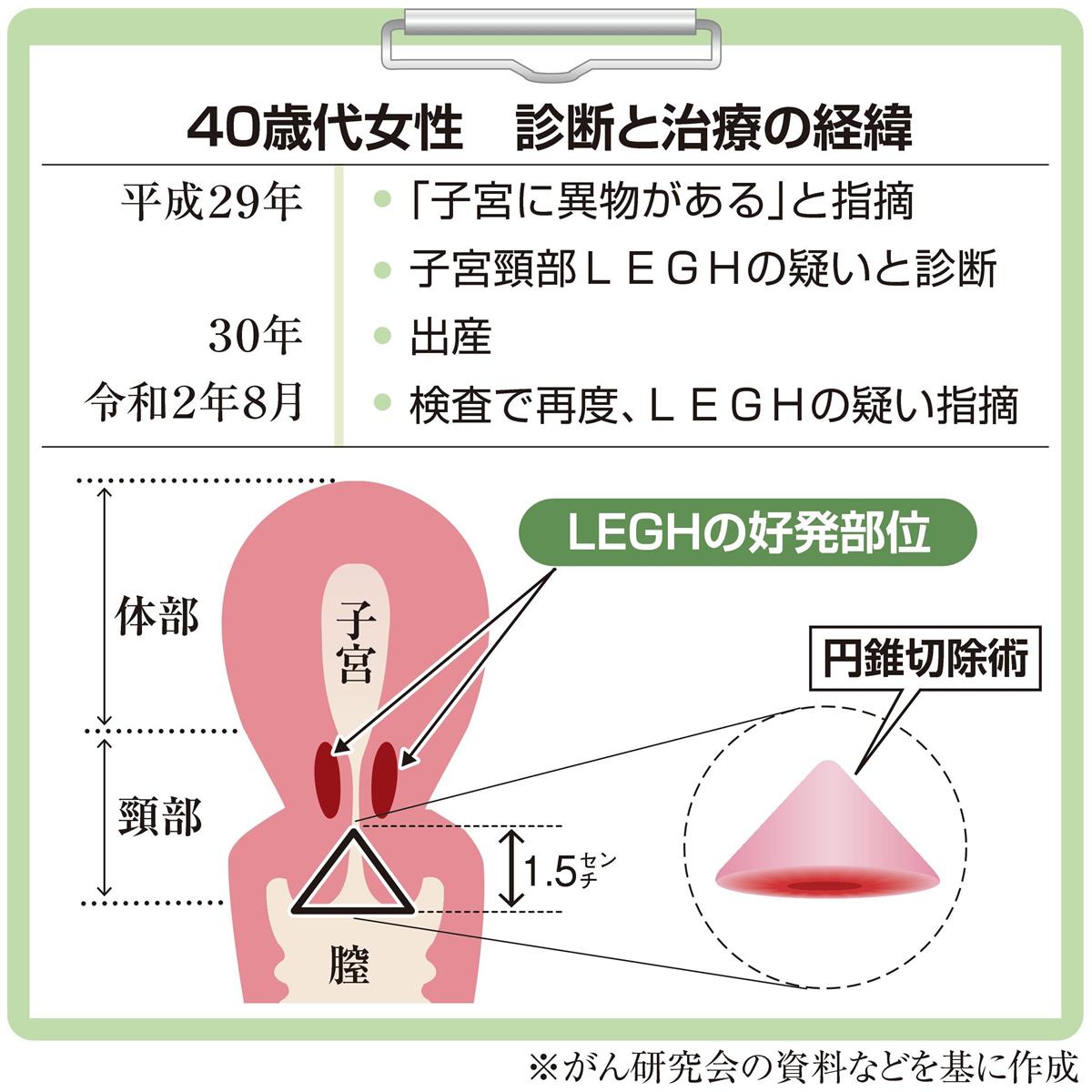 がん電話相談から 子宮頸部ｌｅｇｈ 子宮全摘出を勧められた 産経ニュース