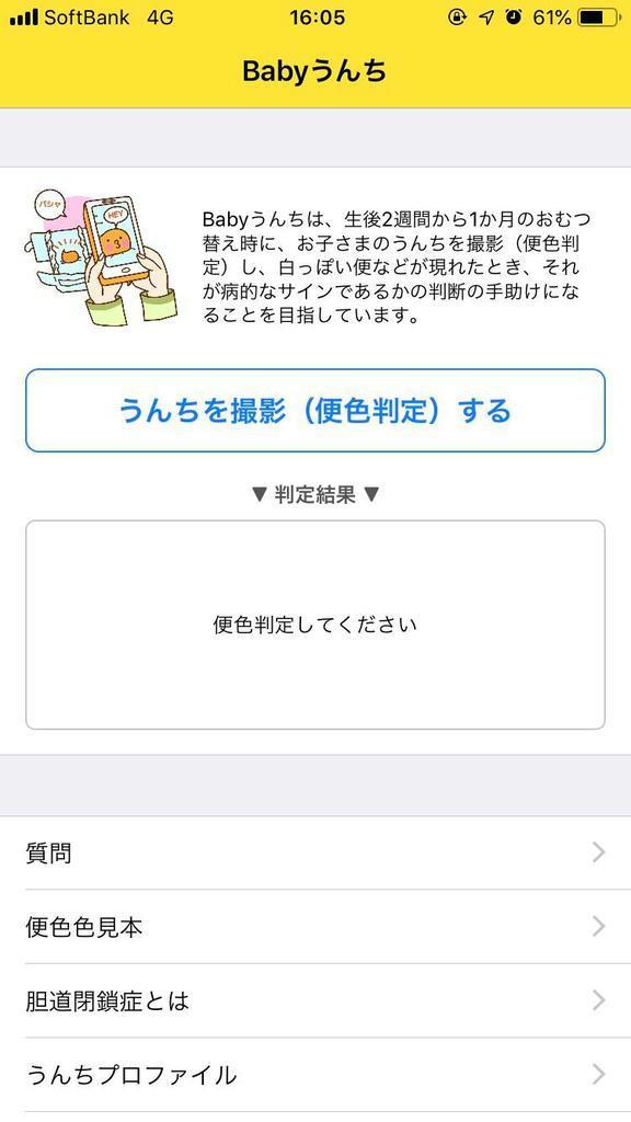 命に関わる難病 胆道閉鎖症 赤ちゃんの便色チェックが必須 1 2ページ 産経ニュース