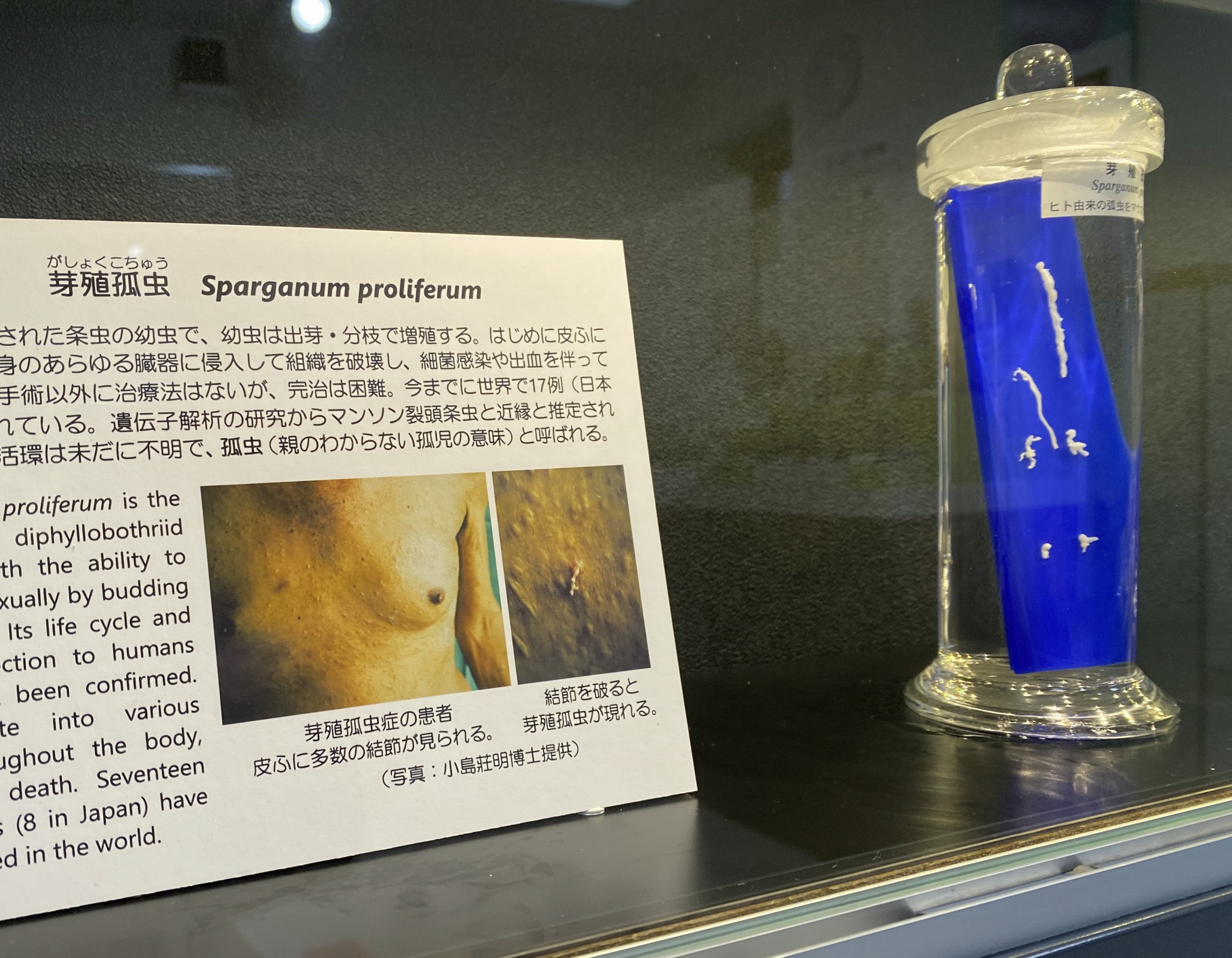 TOKYOまち・ひと物語】謎の寄生虫「芽殖孤虫」を追え