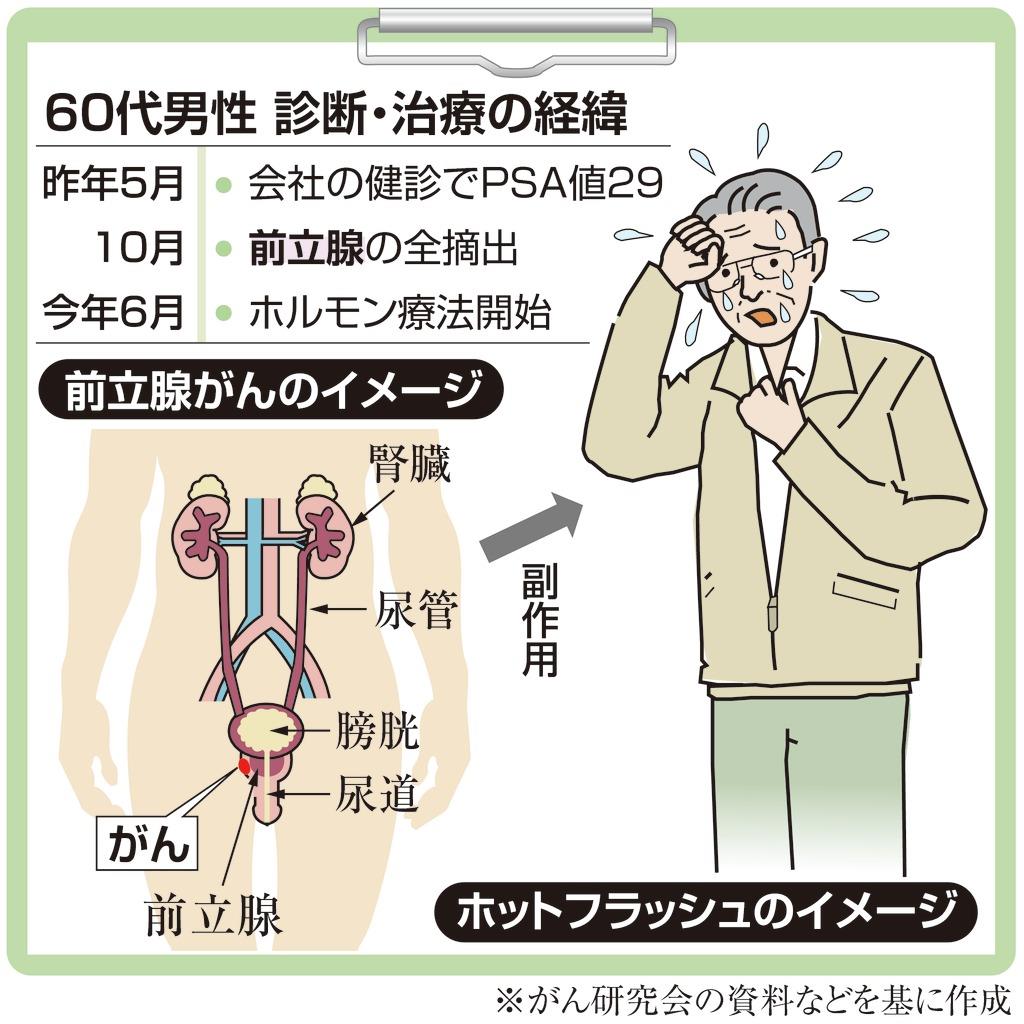 大切な 男性 前立腺癌治療後の排尿障害用の医療サポーター機能