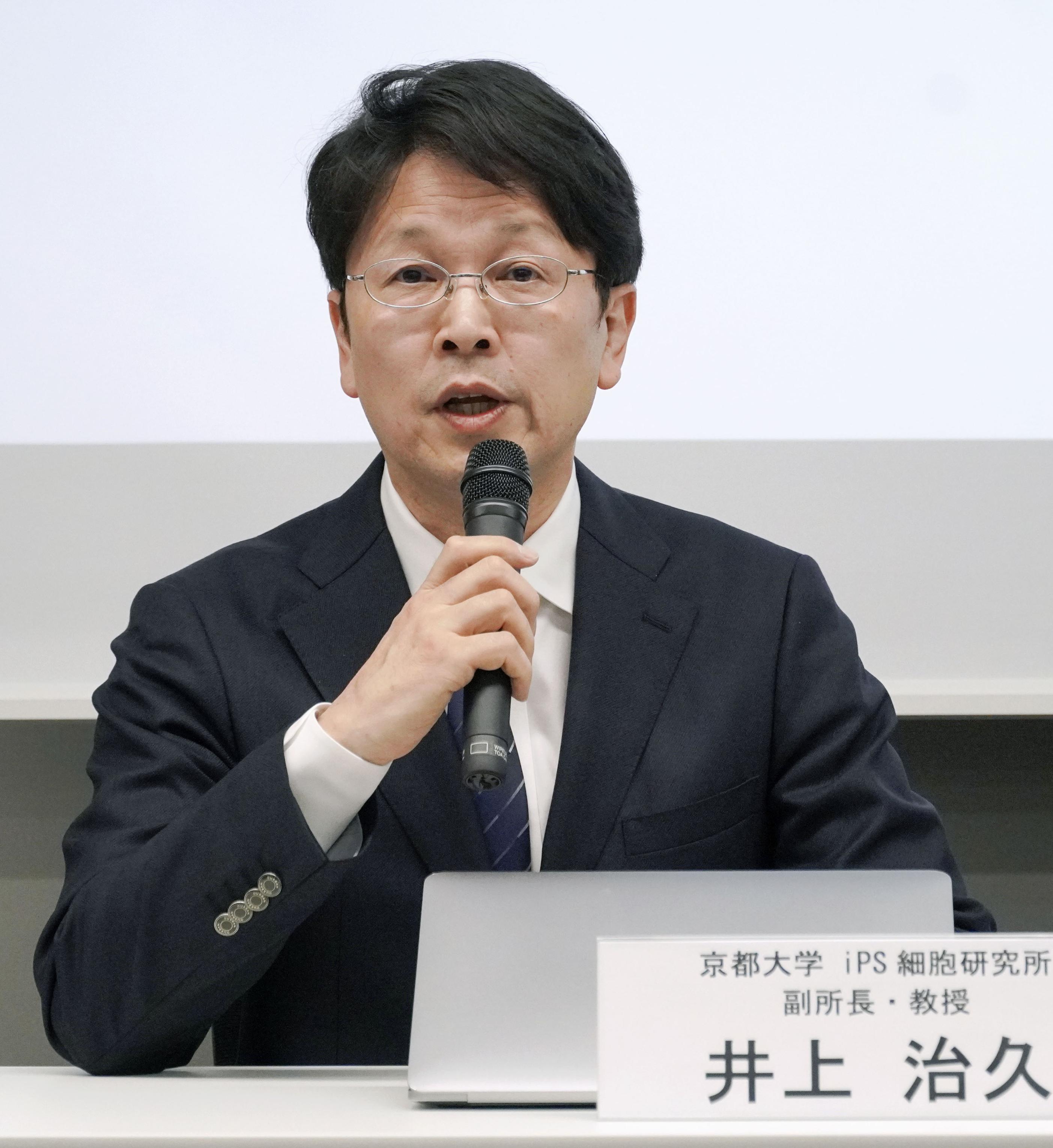 家族性アルツハイマー病の抑制、iPS創薬で最終段階の治験開始 京大など