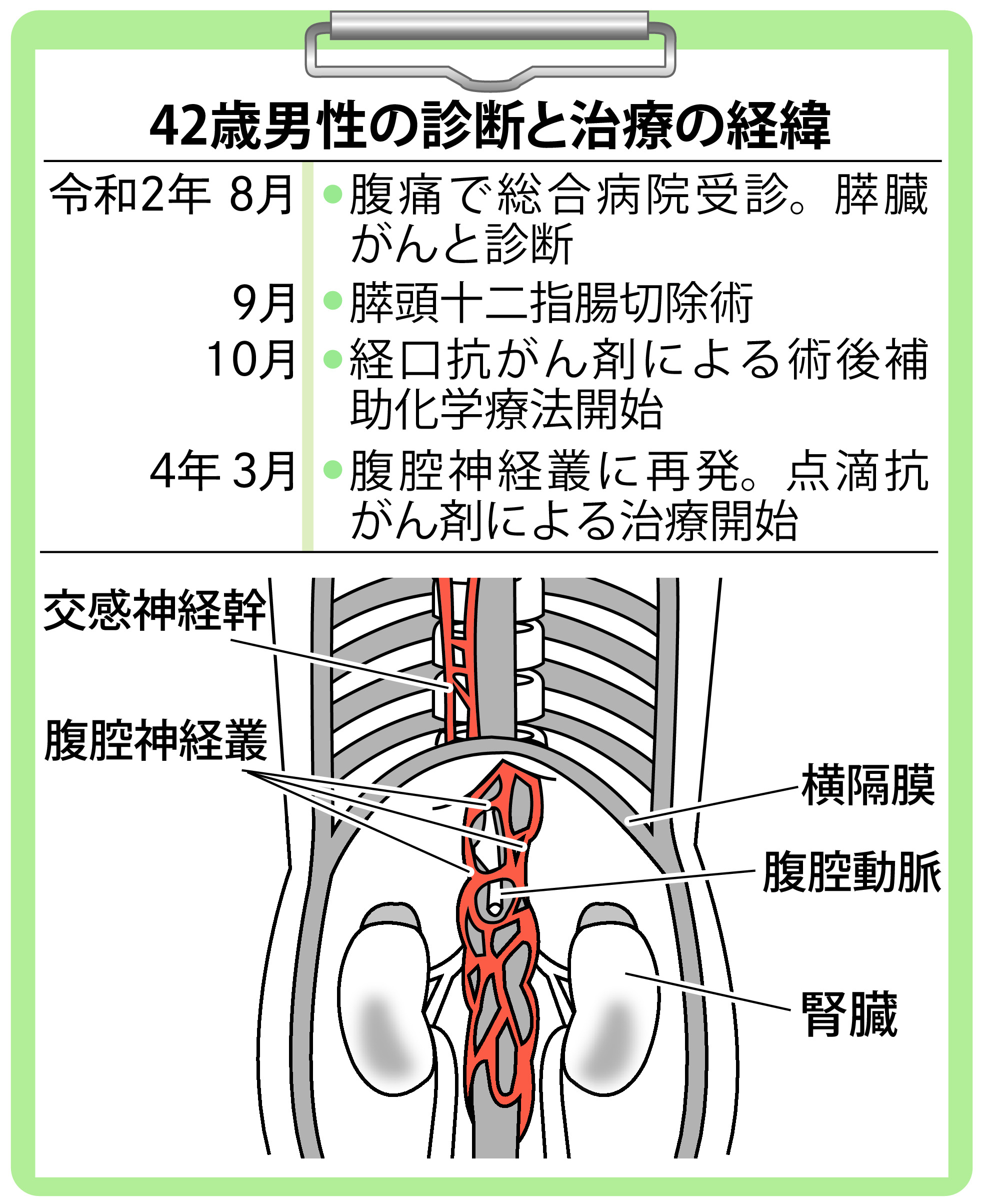 膵臓 癌 痛み