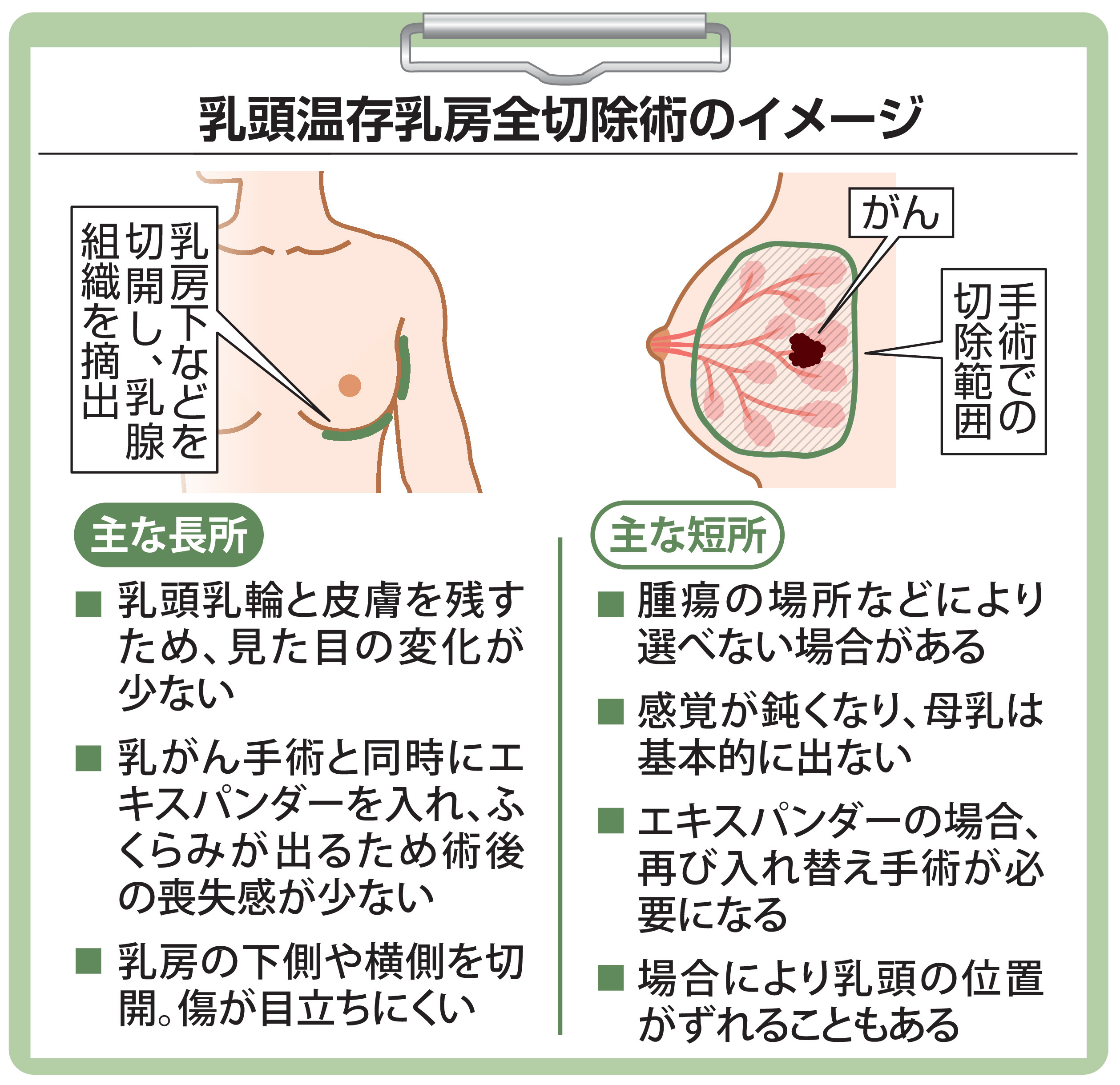 乳がん治療中の50代女性 再発リスクや治療法、乳房再建の時期に悩み が