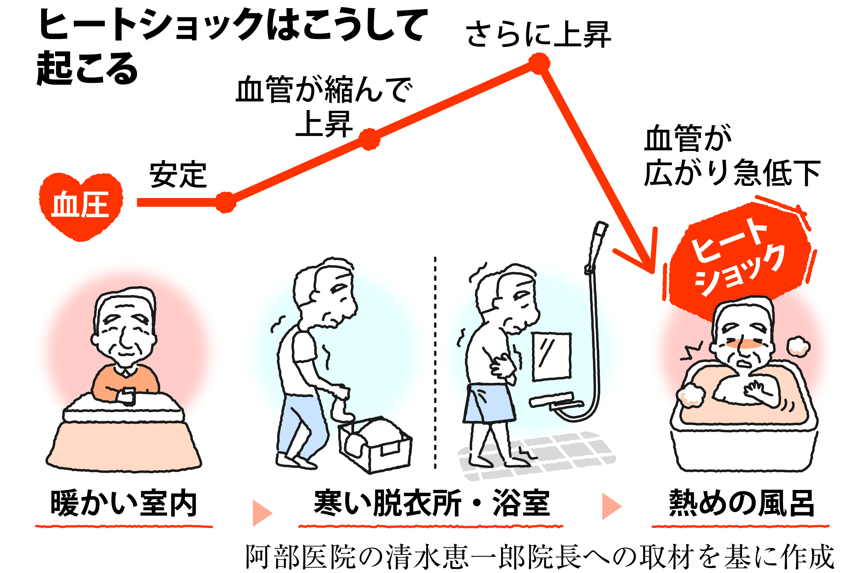 節電の冬 寒暖差による「ヒートショック」に注意を - 産経ニュース
