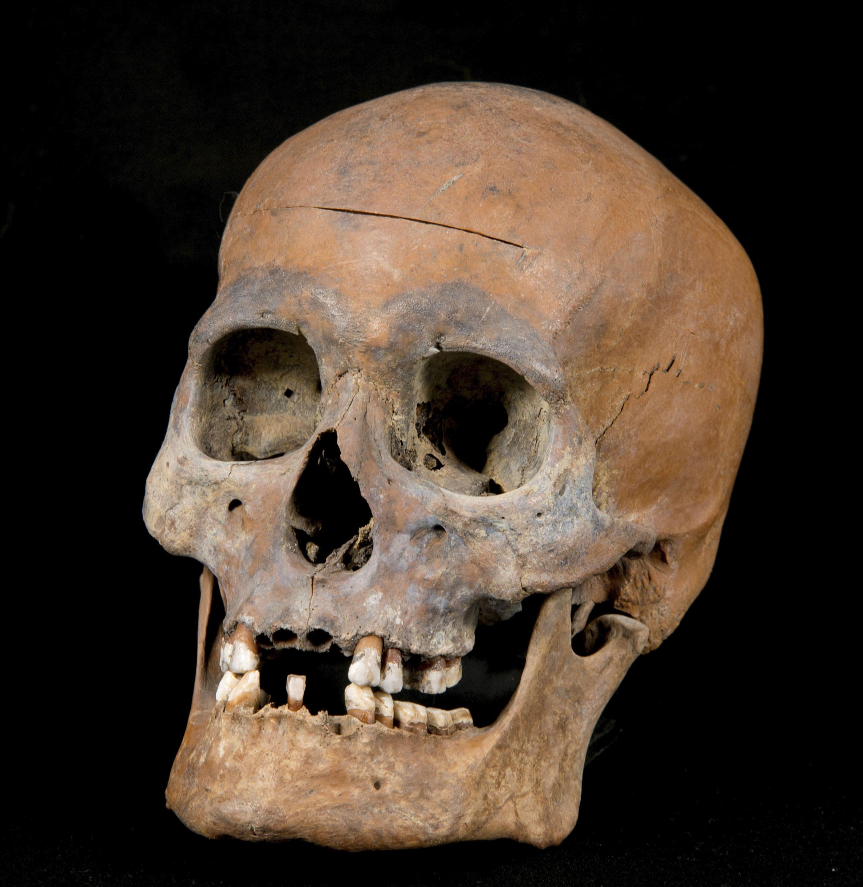 復顔が完成、1800年前の弥生人 「その辺りに居るお兄ちゃんのよう