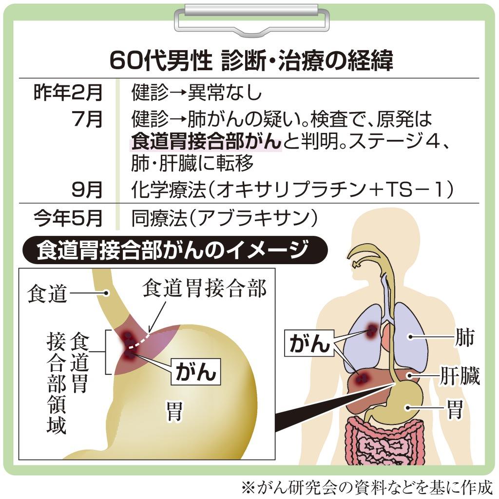 がん電話相談から ｑ 食道胃接合部がん 副作用でボタンもかけられない 産経ニュース