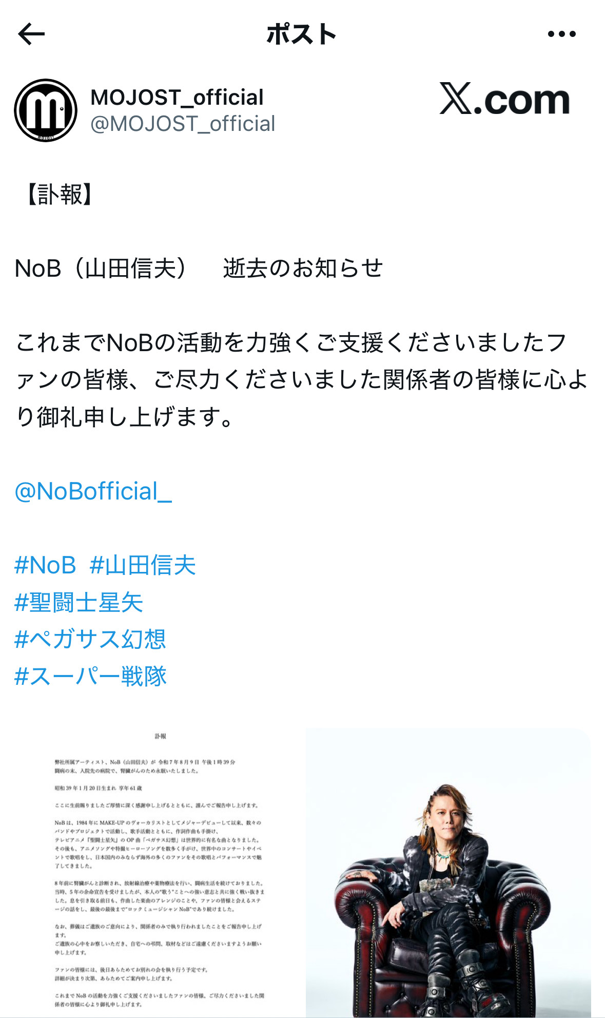 NoB・山田信夫さん61歳で「死去」死因と余命宣告 聖闘士星矢の主題歌