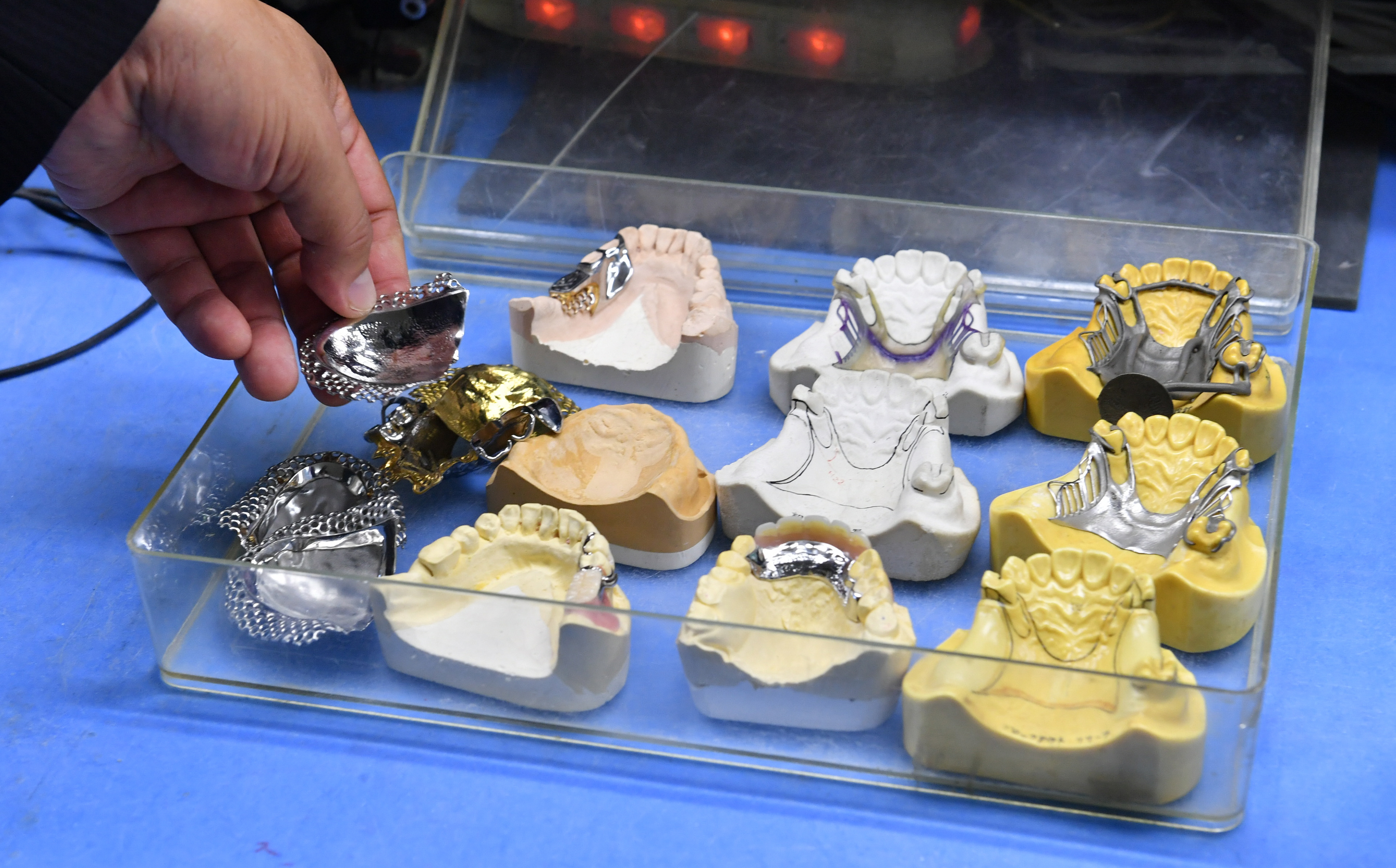 ラジオ経営者列伝】売上高130億円 入れ歯差し歯最大手の未来 - 産経